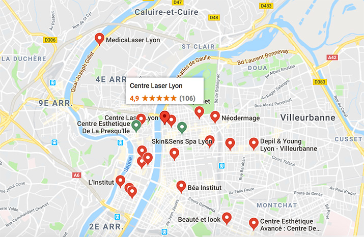 Où se faire épiler à Lyon ? guide et carte des centres d'épilation
